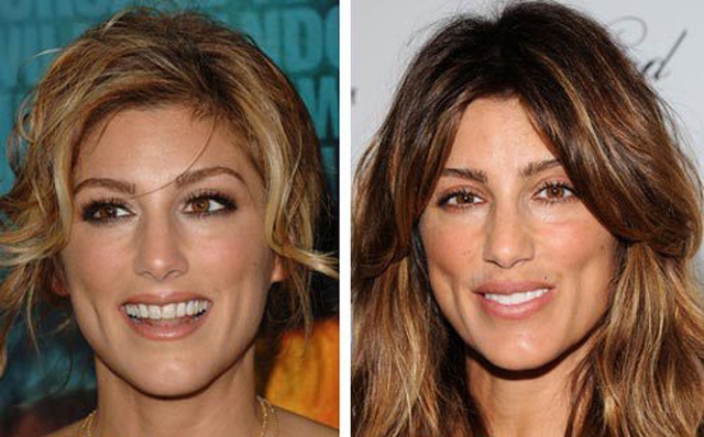 Jennifer Esposito Facelift Plastic Surgery Before and After | Celebie