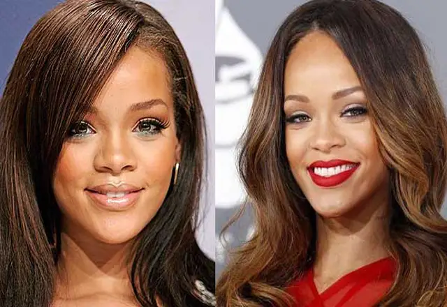 Rihanna Nose Job Plastic Surgery Before and After | Celebie