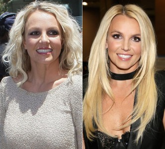 Britney Spears Plastic Surgery Before and After Botox Injections | Celebie