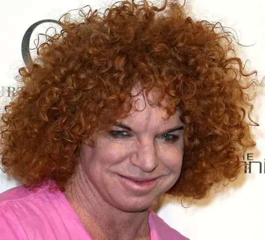 Carrot Top Plastic Surgery Before And After Botox Injections Celebie 