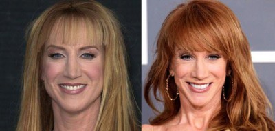 Kathy Griffin Nose Job Plastic Surgery Before And After 