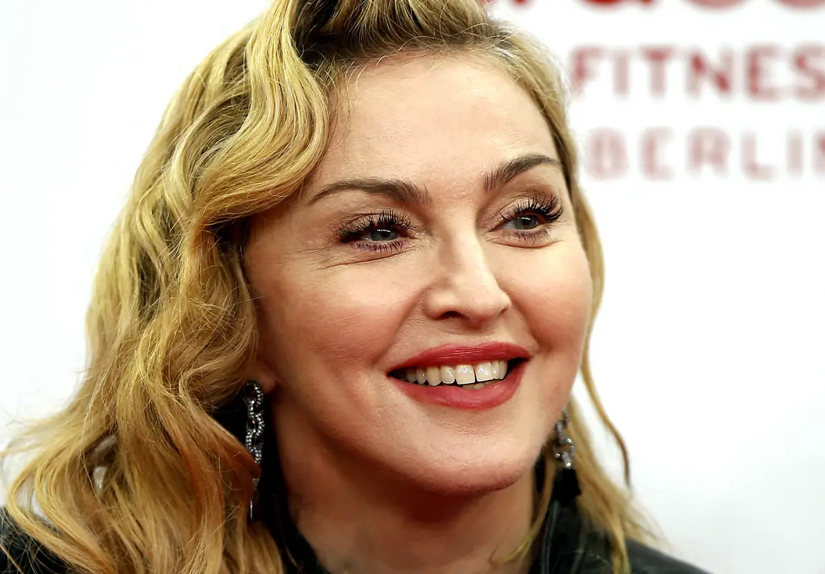 Madonna Facelift Plastic Surgery Before and After | Celebie