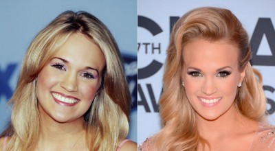 Carrie Underwood Nose Job Plastic Surgery Before and After | Celebie