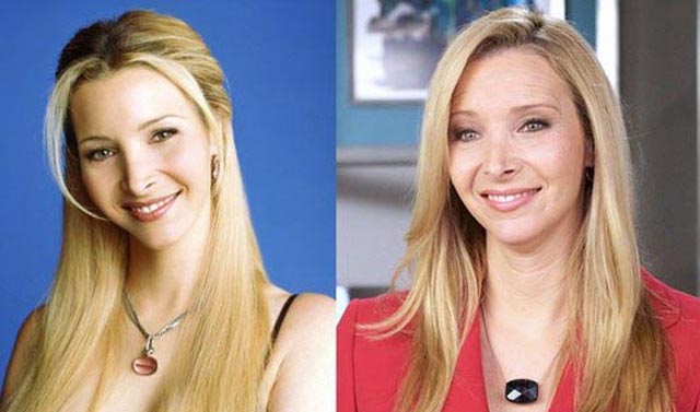 Lisa Kudrow Plastic Surgery Before and After Botox Injections | Celebie