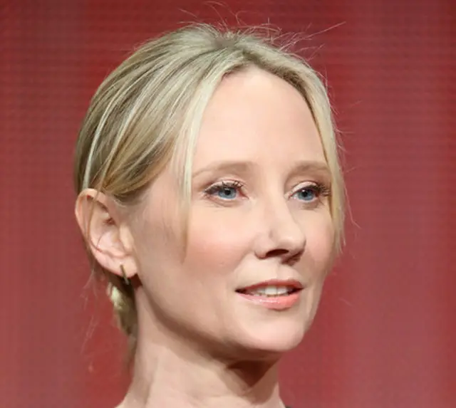 Anne Heche Nose Job Plastic Surgery Before and After | Celebie