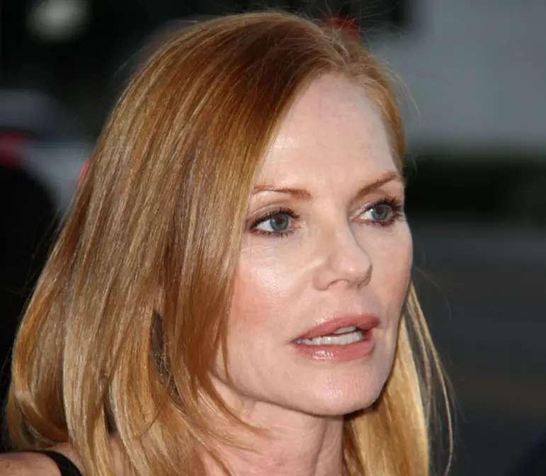 Marg Helgenberger Plastic Surgery Before and After Celebie.